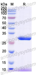 Recombinant Mouse SIGLEC12 Protein, N-His