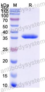 Recombinant Mouse FPN1/SLC40A1/Ferroportin Protein, N-GST & C-His