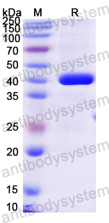 Recombinant Mouse IL1RAP Protein, N-His