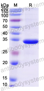 Recombinant Mouse FGF21 Protein, N-His-SUMO & C-Strep