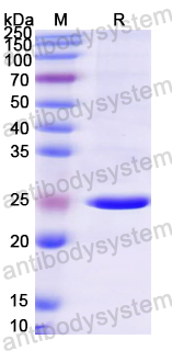 Recombinant Mouse TREX1 Protein, N-His