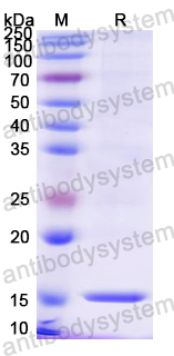 Recombinant Mouse TREM2 Protein, N-His