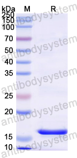 Recombinant Mouse HDAC9 Protein, N-His