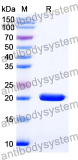 Recombinant Mouse CD265/TNFRSF11A Protein, N-His