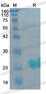 Recombinant Mouse Fbxo2 Protein, N-His
