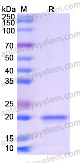 Recombinant Mouse TRBC1 Protein, N-His