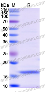 Recombinant Mouse VSIG4/CRIg Protein, C-His