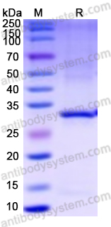 Recombinant Mouse METRNL/Subfatin Protein, N-His