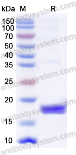 Recombinant Mouse RNF43 Protein, N-His