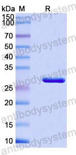 Recombinant Mouse ST14 Protein, N-His