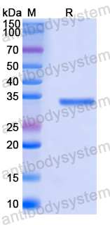 Recombinant Mouse RTN4R Protein, N-His