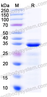 Recombinant Mouse VSTM4 Protein, N-His-SUMO