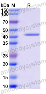 Recombinant Mouse DAND5 Protein, N-GST & C-His