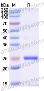 Recombinant Mouse ROBO2 Protein, N-His