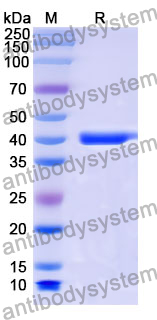 Recombinant Mouse SMOC2 Protein, N-GST & C-His