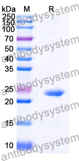 Recombinant Mouse VSIG2 Protein, N-His