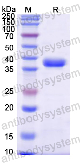 Recombinant Mouse NRN1/Neuritin Protein, N-GST & C-His