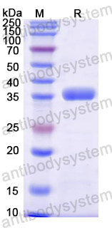 Recombinant Mouse ERRFI1 Protein, N-GST & C-His