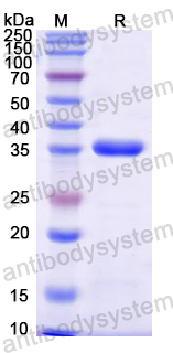 Recombinant Mouse Pramel12 Protein, N-His-KSI
