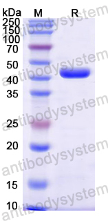 Recombinant Mouse TAPBPL Protein, N-His