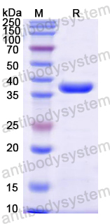 Recombinant Mouse Ly6c2 Protein, N-GST & C-His