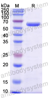 Recombinant Mouse NHERF-3/PDZK1 Protein, N-10*His
