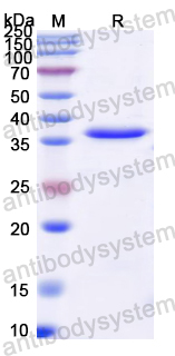 Recombinant Pig Uricase/Uox Protein, N-His