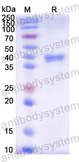 Recombinant Rat GSN Protein, N-His