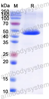 Recombinant Rat GALT Protein, N-His
