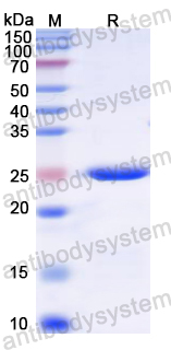 Recombinant Rat CD13/ANPEP/APN Protein, N-His