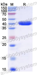 Recombinant Rat CD192/CCR2 Protein, N-GST & C-His