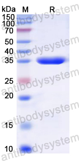 Recombinant Rat CD192/CCR2 Protein, N-GST & C-His