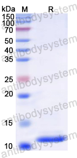 Recombinant Rat PTH1R Protein, N-His