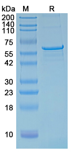 Recombinant Rat ANK3 Protein, C-His