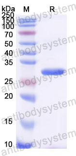 Recombinant Rat FGL2 Protein, N-His