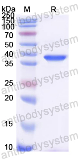 Recombinant Rat Uricase/Uox Protein, N-His