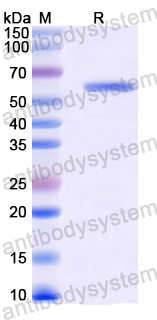 Recombinant Rabbit PKM Protein, C-His