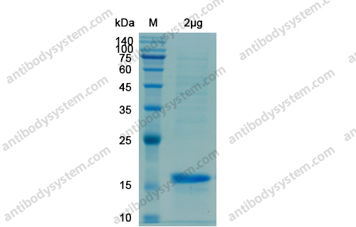Recombinant SARS-CoV-2 M Protein, N-His