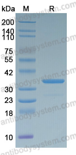 Recombinant SARS-CoV-2 M Protein, N-GST & C-His