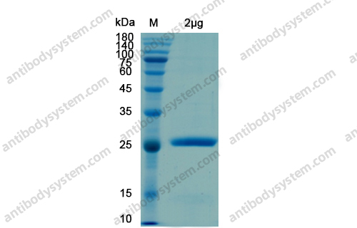Recombinant SARS-CoV-2 NSP8 Protein, N-His