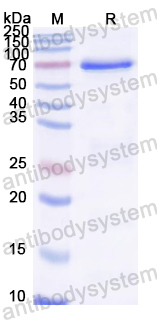 Recombinant RABV NP/Nucleoprotein Protein, N-Trx-His & C-His