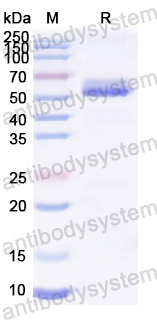 Recombinant ZEBOV GP1 Protein, N-His
