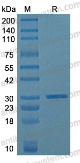 Recombinant Influenza A virus (H2N2) HA/Hemagglutinin Protein, N-His