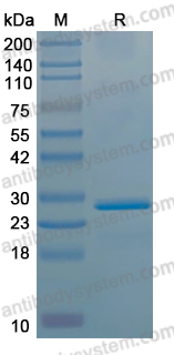 Recombinant Influenza A virus (H4N6) HA/Hemagglutinin Protein, N-His
