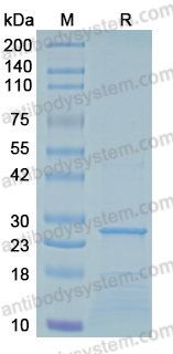 Recombinant Influenza A virus (H3N2) HA/Hemagglutinin Protein, N-His