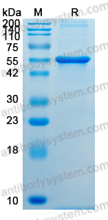 Recombinant Influenza A virus (H5N1) HA/Hemagglutinin Protein, N-His