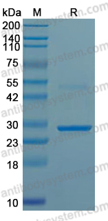 Recombinant Influenza A virus (H7N7) HA/Hemagglutinin Protein, N-His