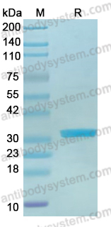 Recombinant Influenza A virus (H8N4) HA/Hemagglutinin Protein, N-His