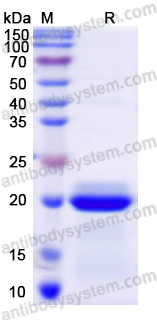 Recombinant Lassa virus/LASV GPC Protein, N-His