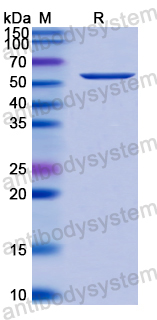 Recombinant TRSV 2C-CP/Coat protein, C-His